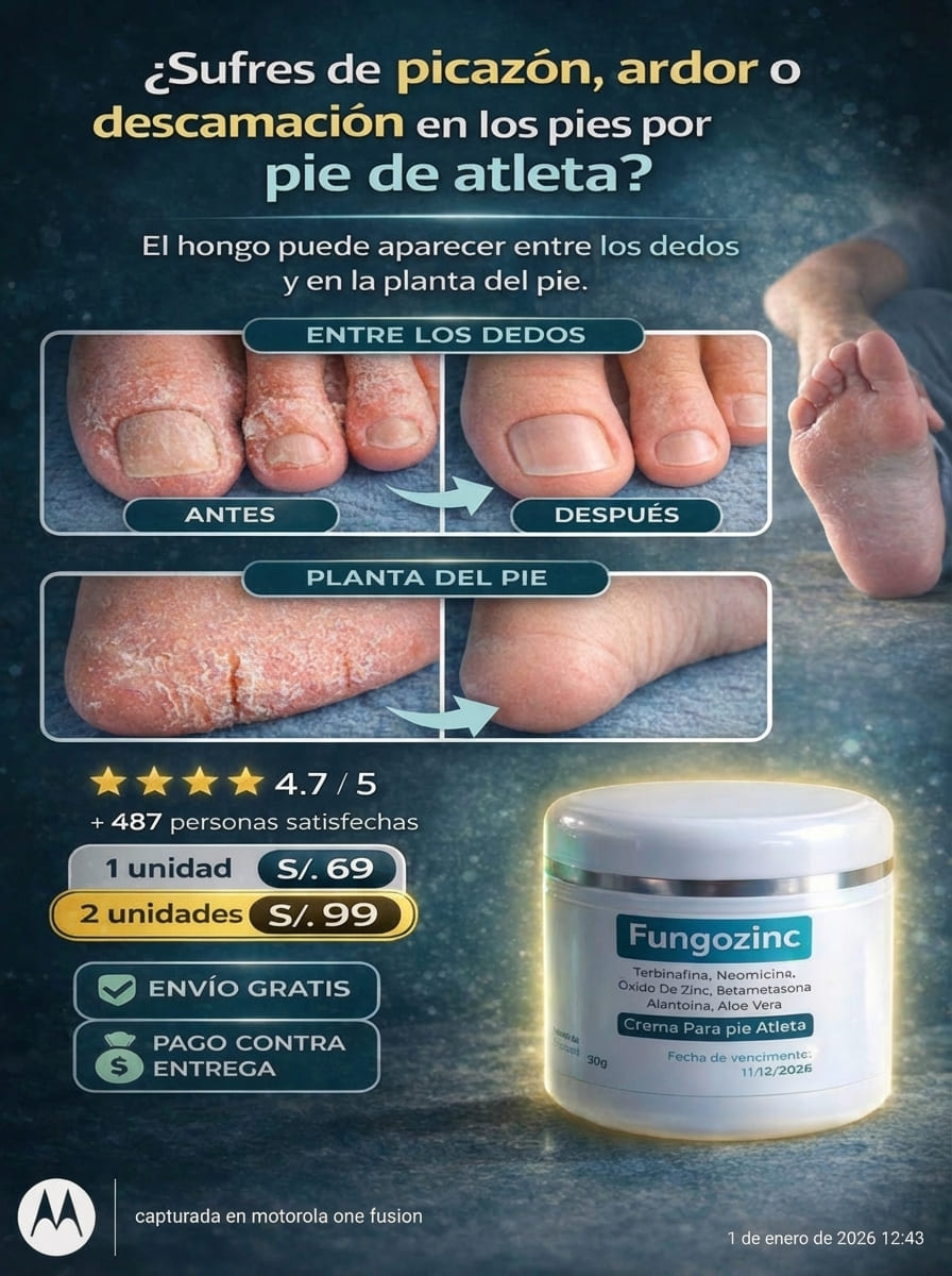 Fungozinc – Crema para el Pie de Atleta